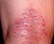 ������Ƥ��