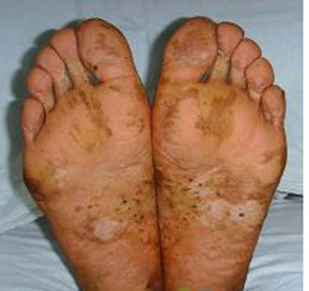 ����Ƥ������Ѣ