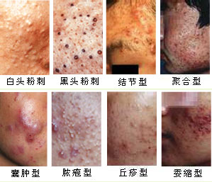 ������Ƥ����ҽԺ ��ͬ���͵��