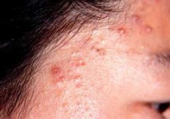 ֬����Ƥ��ͼƬ