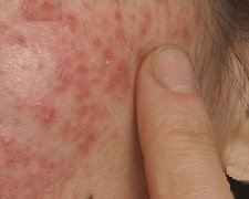 ������Ƥ��ͼƬ